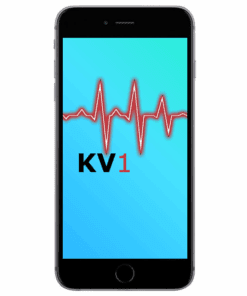 iPhone 6S Äusserliche Schadensanalyse KV1