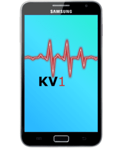 Galaxy Note 1 Kostenvoranschlag 1 Äusserliche Schadensanalyse KV1