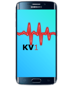 Galaxy S6 Edge Kostenvoranschlag 1 Äusserliche Schadensanalyse KV1