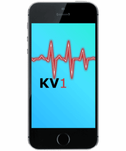 iPhone SE Kostenvoranschlag 1 Äusserliche Schadensanalyse KV1