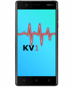 Nokia 3 Äusserliche Schadensanalyse KV1