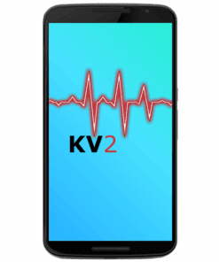 Nexus 6 Diagnose Schadensanalyse KV2