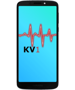 Motorola Moto G6 Play - Äußerliche Schadensanalyse KV1