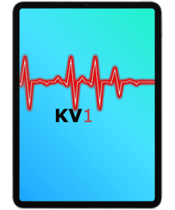 iPad Pro 11" Äusserliche Schadensanalyse KV1